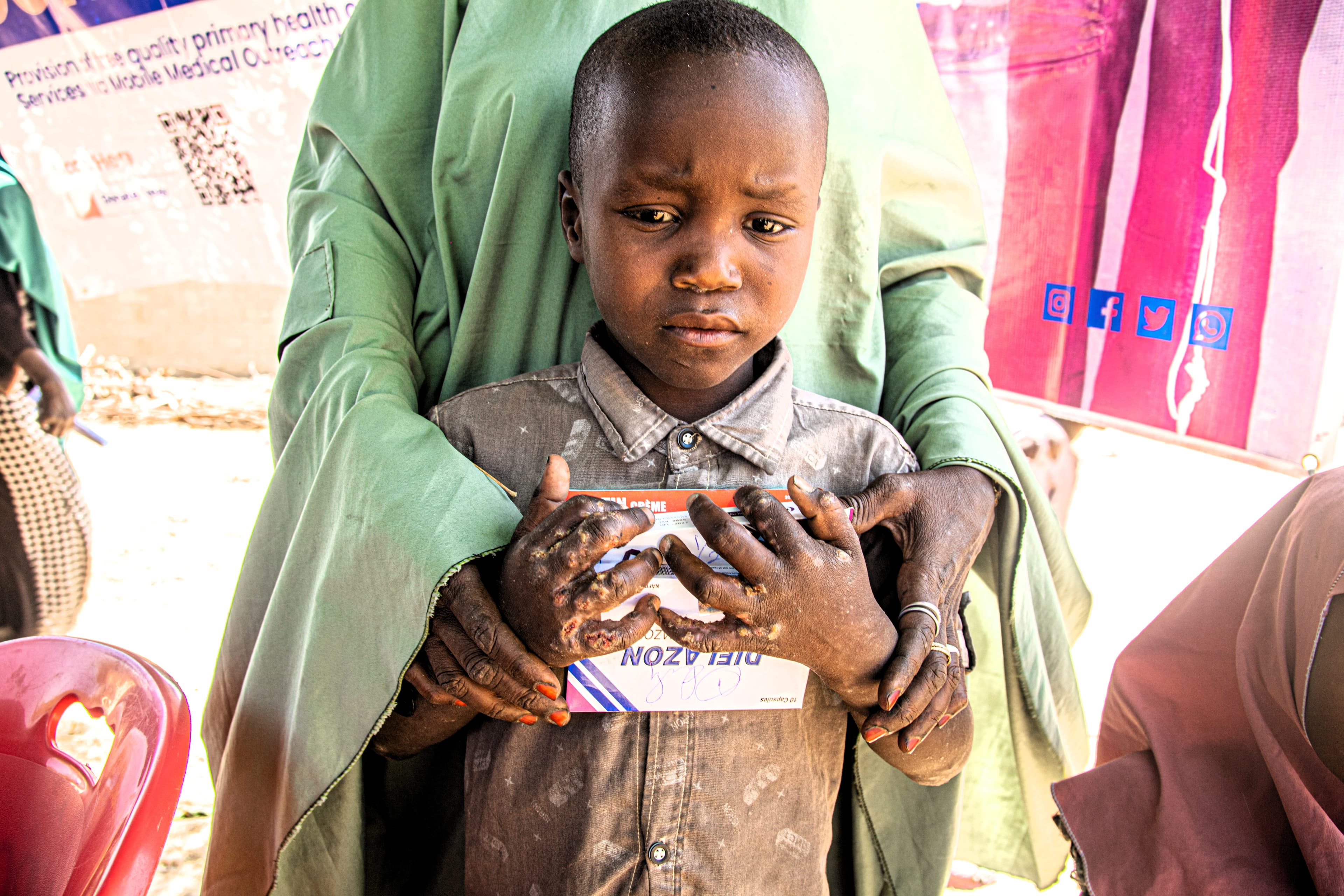 Child receiving medication during medical outreach